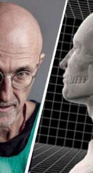 Sergio Canavero, włoski lekarz