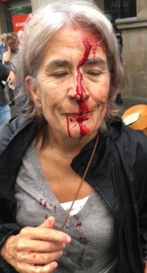 Katalonia: w wyniku starć z policją 337 osób zostało rannych, niektóre ciężko