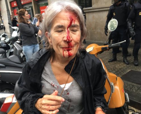 Katalonia: w wyniku starć z policją 337 osób zostało rannych, niektóre ciężko